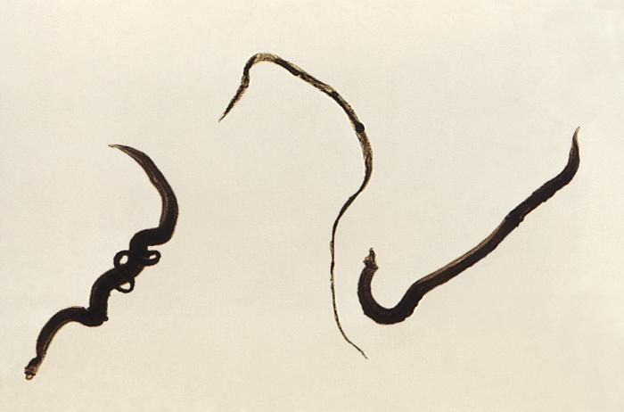 trematodes, mansoni